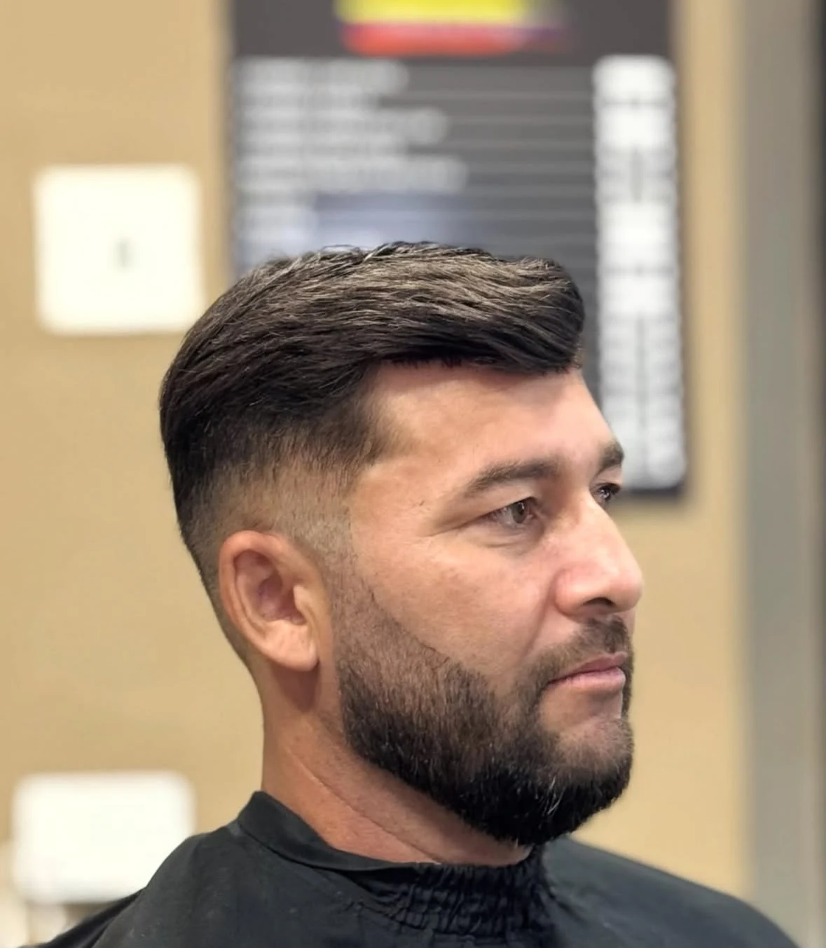 Resultado natural de prótese capilar masculina